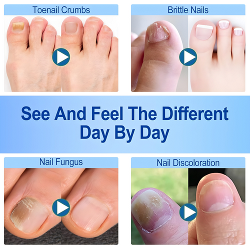 21Pcs Fungal Nail Patches